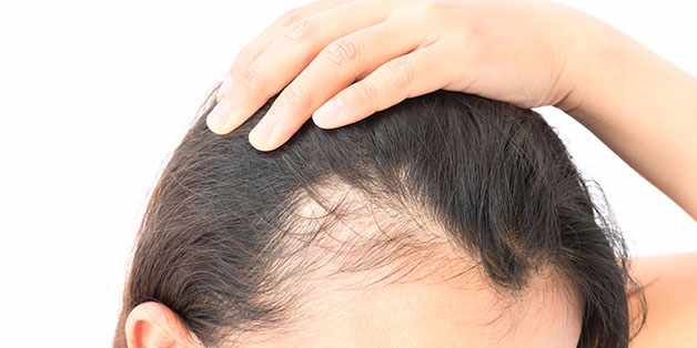 BIO FUE Hair Transplant in Mumbai