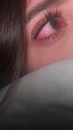 Mental trauma 🤧🔞💋