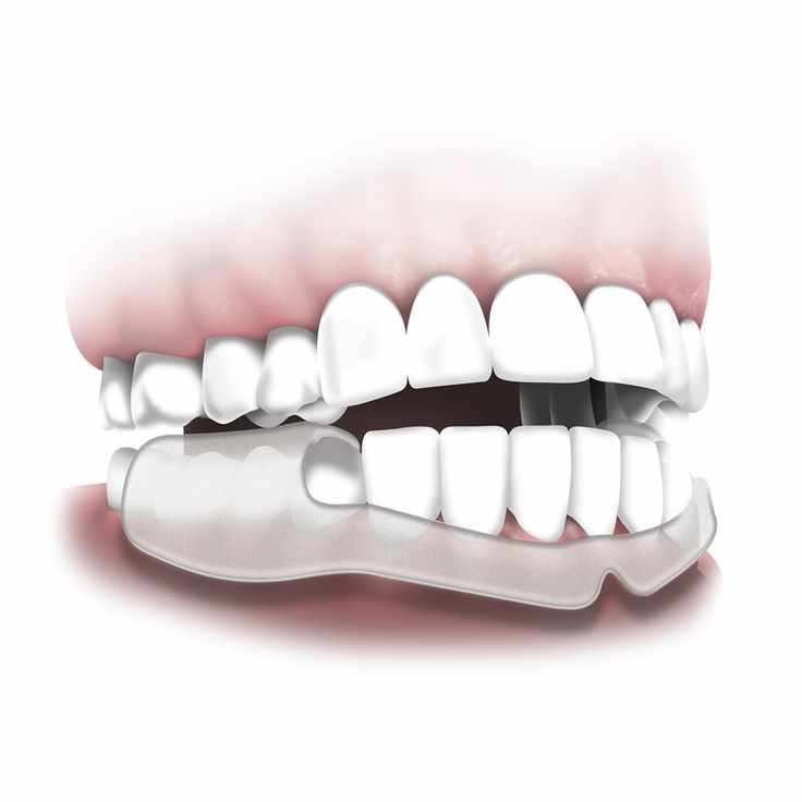 Migraine & Sinus Type Headache Care in Gurgaon at Dr. Gupta's Shri Ram Dental Care