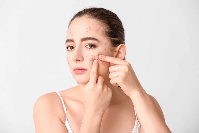 ENDYMED INTENSIF: Advanced Skin Rejuvenation and Acne Scar Treatment in Delhi