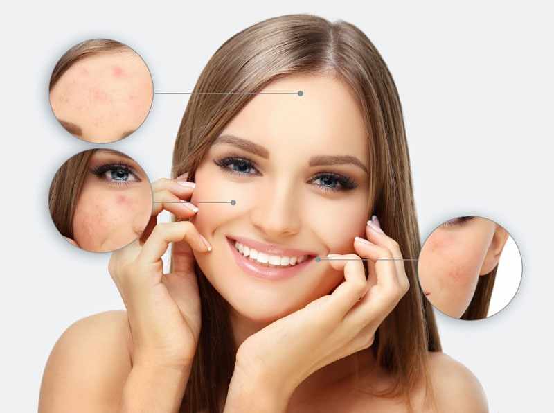 Facial Pigmentation Treatment in Delhi: A Dermatologist’s Guide to Clear, Even Skin