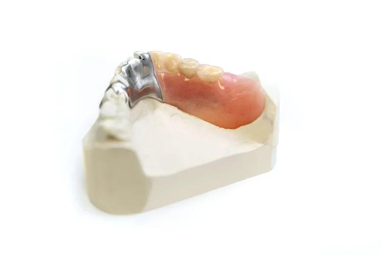 Dental Services is all-in-oneFull Dentures Hamilton - Hamilton Dental Care
