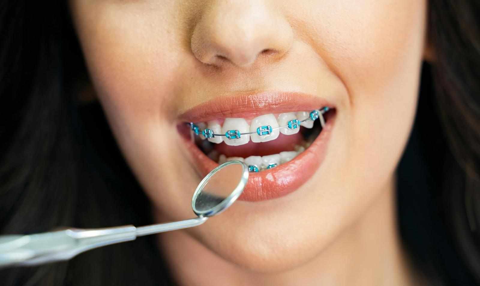How Bite Correction Impacts Facial Balance and Long-Term Oral Stability