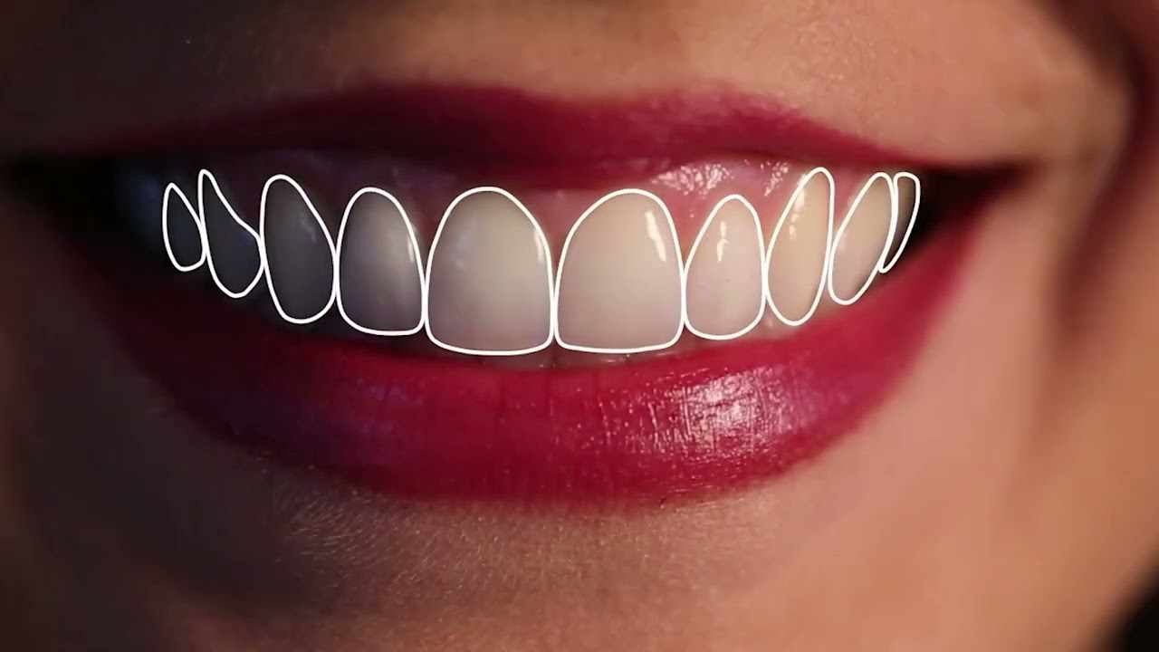 Modern Pathways to a Better Smile: How Digital Planning is Changing Indian Dentistry