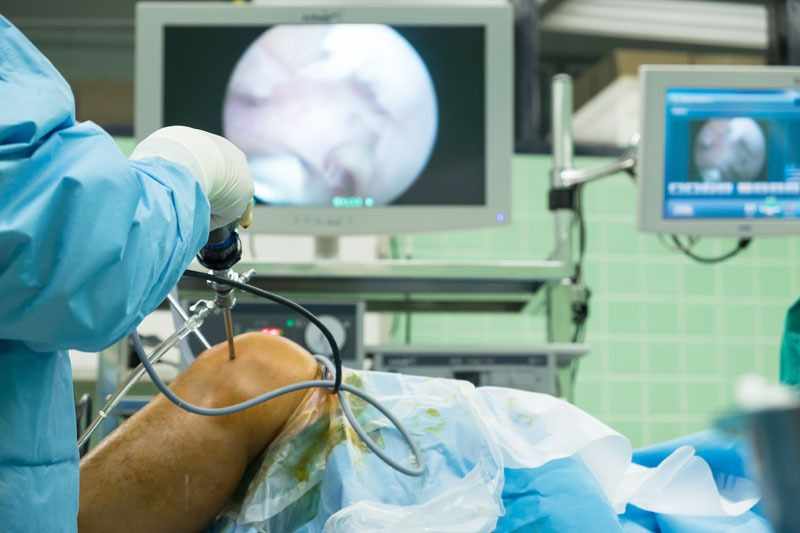 Treating Joint Injuries Safely with Arthroscopic Surgery Delhi