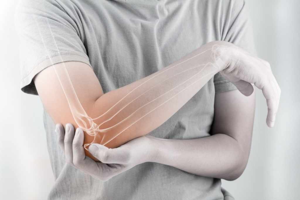Relieving Elbow Pain with Advanced Total Elbow Replacement Surgery in Delhi