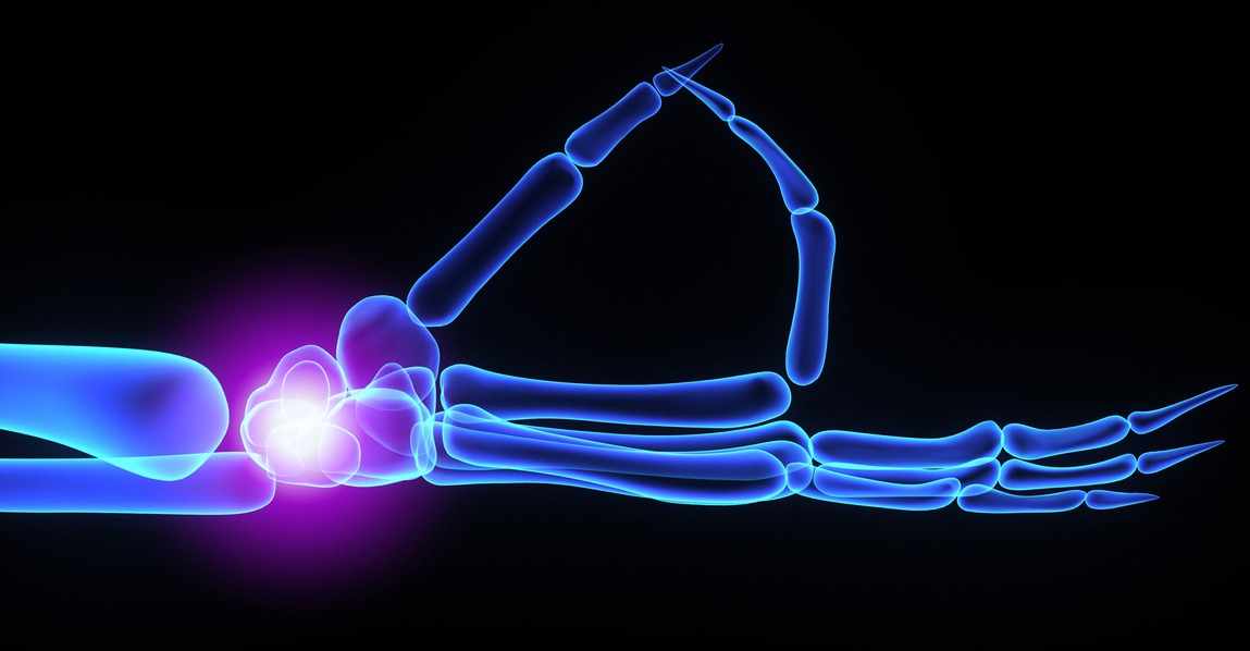 When Wrist Pain Needs Surgery: A Guide to Total Wrist Replacement Surgery in Delhi