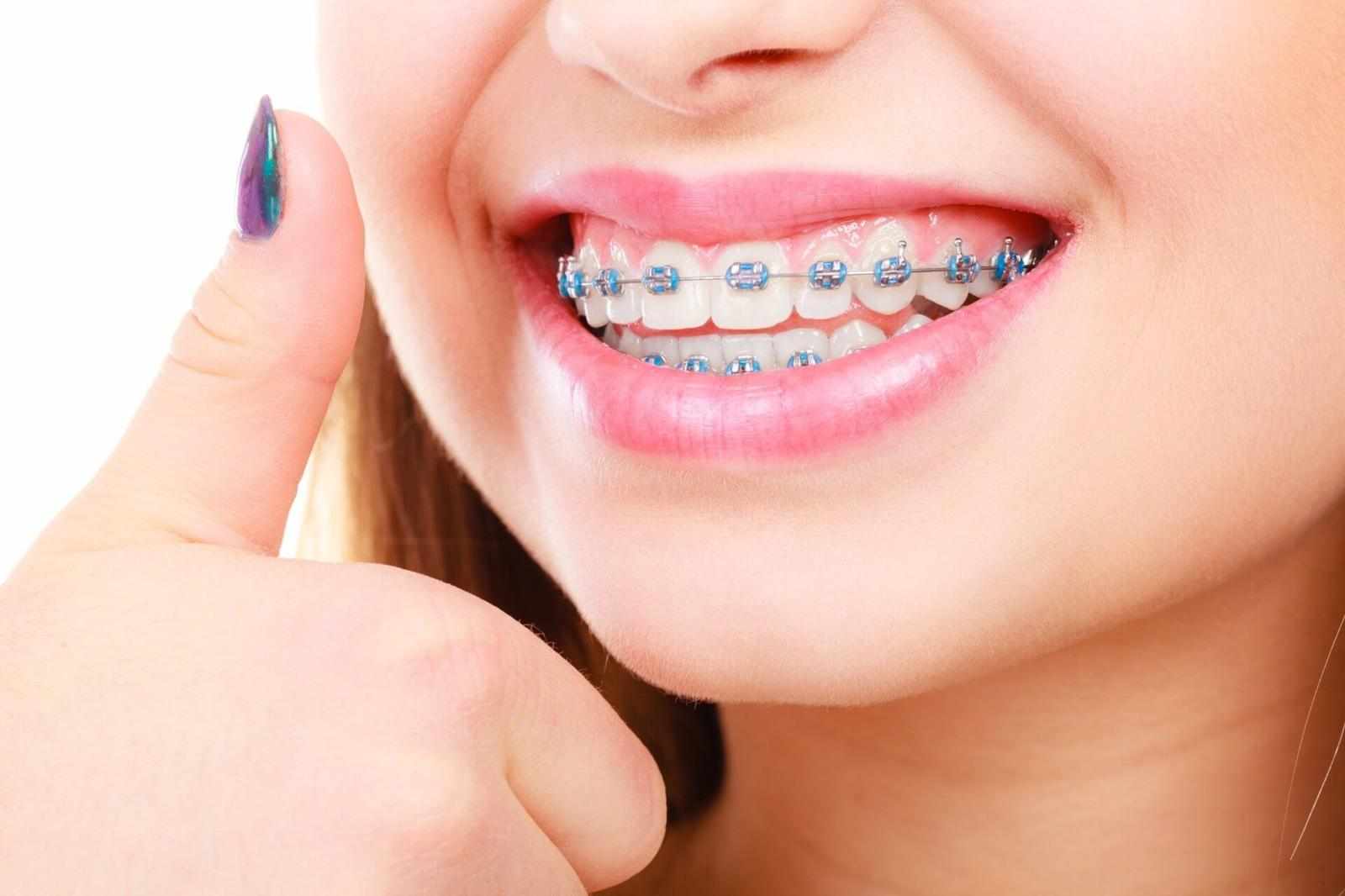 Modern Approaches to Braces Treatment in Wanowrie for a Better Smile