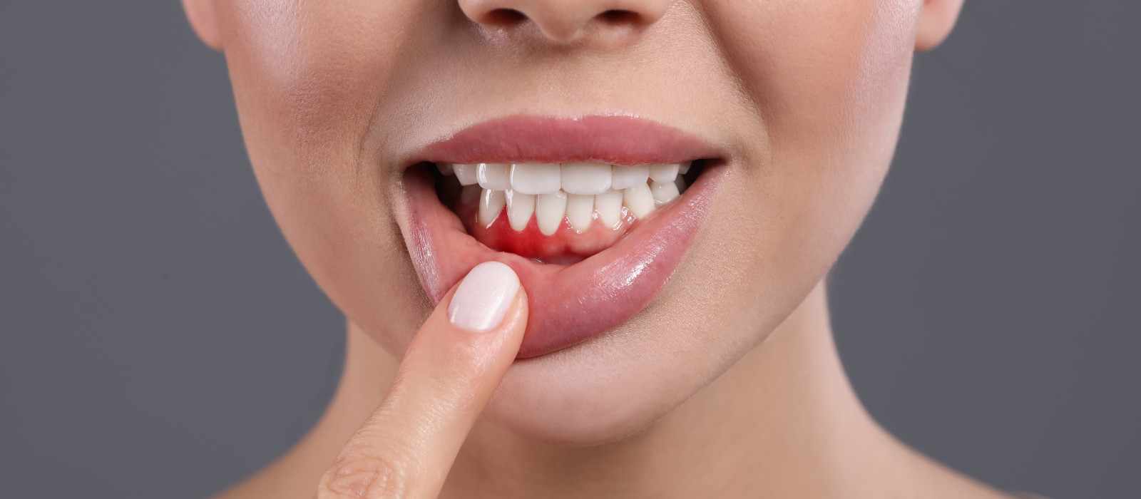 Essential Guide to Maintaining Healthy Smiles with Gum Treatment in Bhandara
