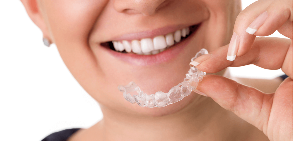 Boost Your Daily Confidence with Invisalign Braces in Bhandara