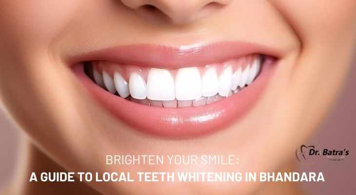 Brighten Your Smile: A Guide to Local Teeth Whitening in Bhandara
