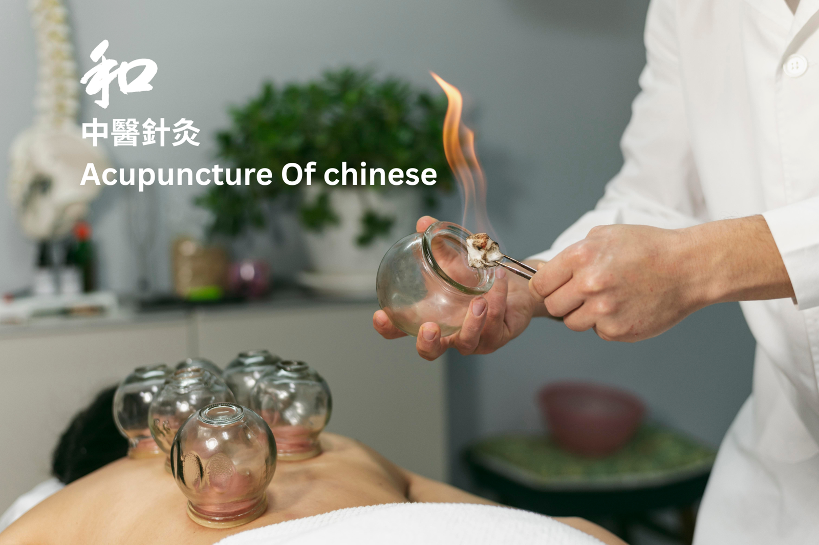 Professional Acupuncture Of Chinese Treatment at He Acupuncture