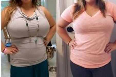 Body Lift in Dubai: Understanding Modern Body Contouring Procedures