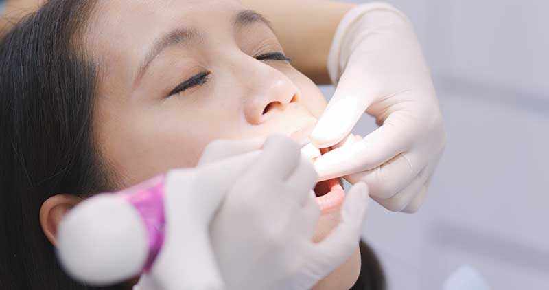 Top 10 Dental Myths You Should Stop Believing