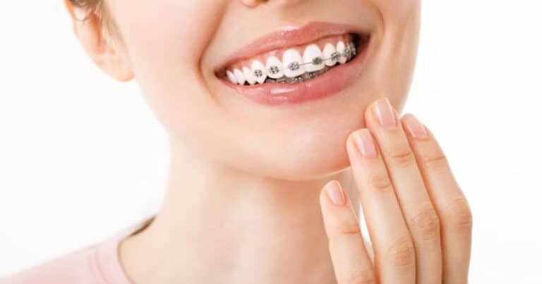 How is Life After Braces?