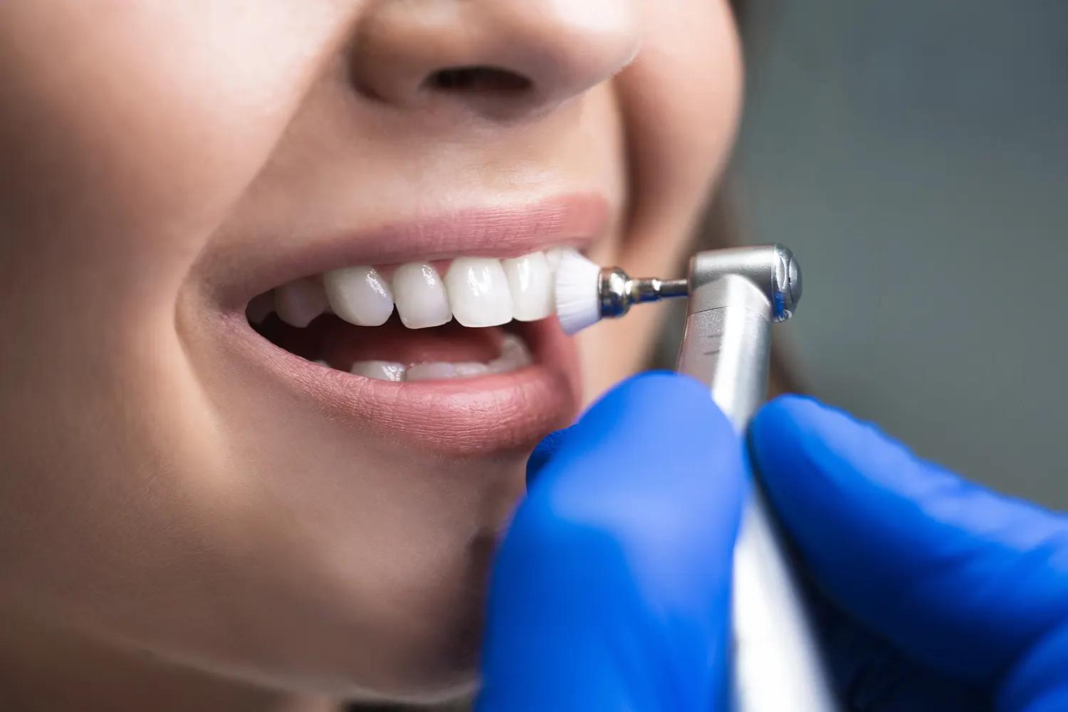 The Importance of Professional Dental Cleanings: Beyond Just Brushing and  Flossing | Smile Care Raytown