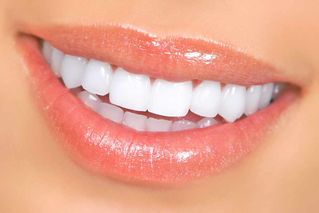 How To Keep Your Teeth White After Whitening - Memorial City Dentistry