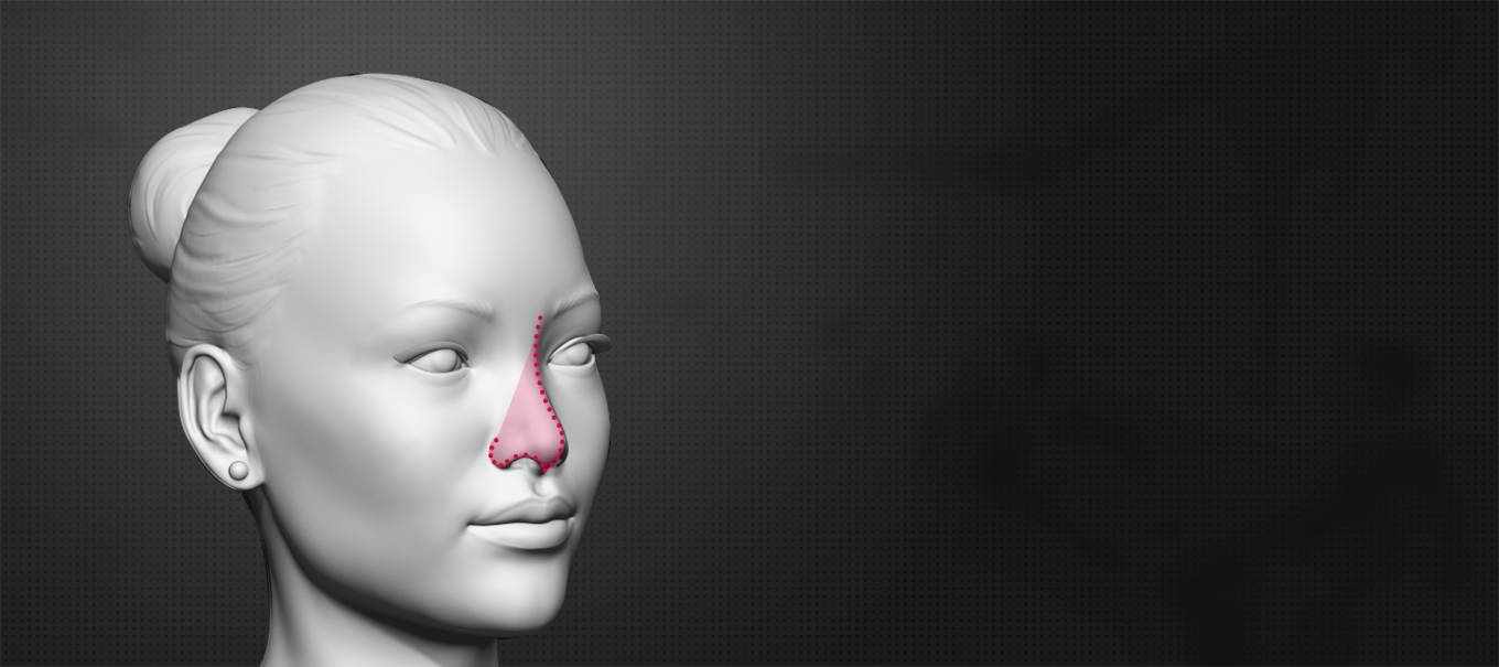 Common Fears About Facial Feminization Surgery