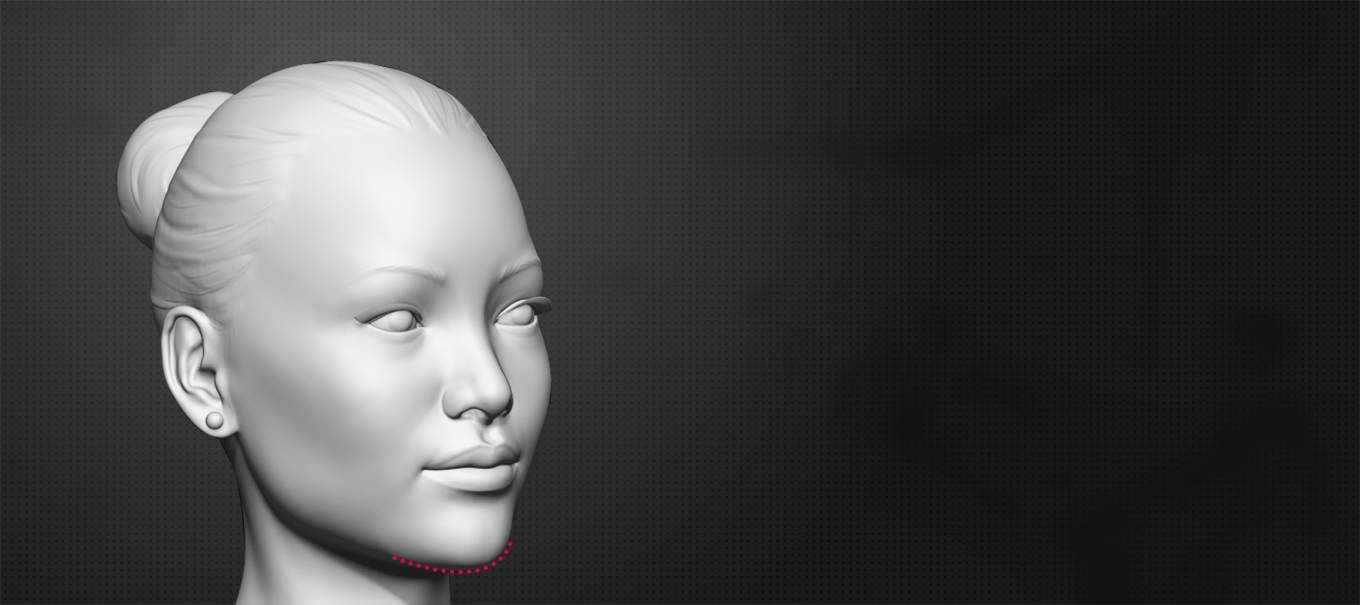 How to get feminine jawline with chin reduction surgery?