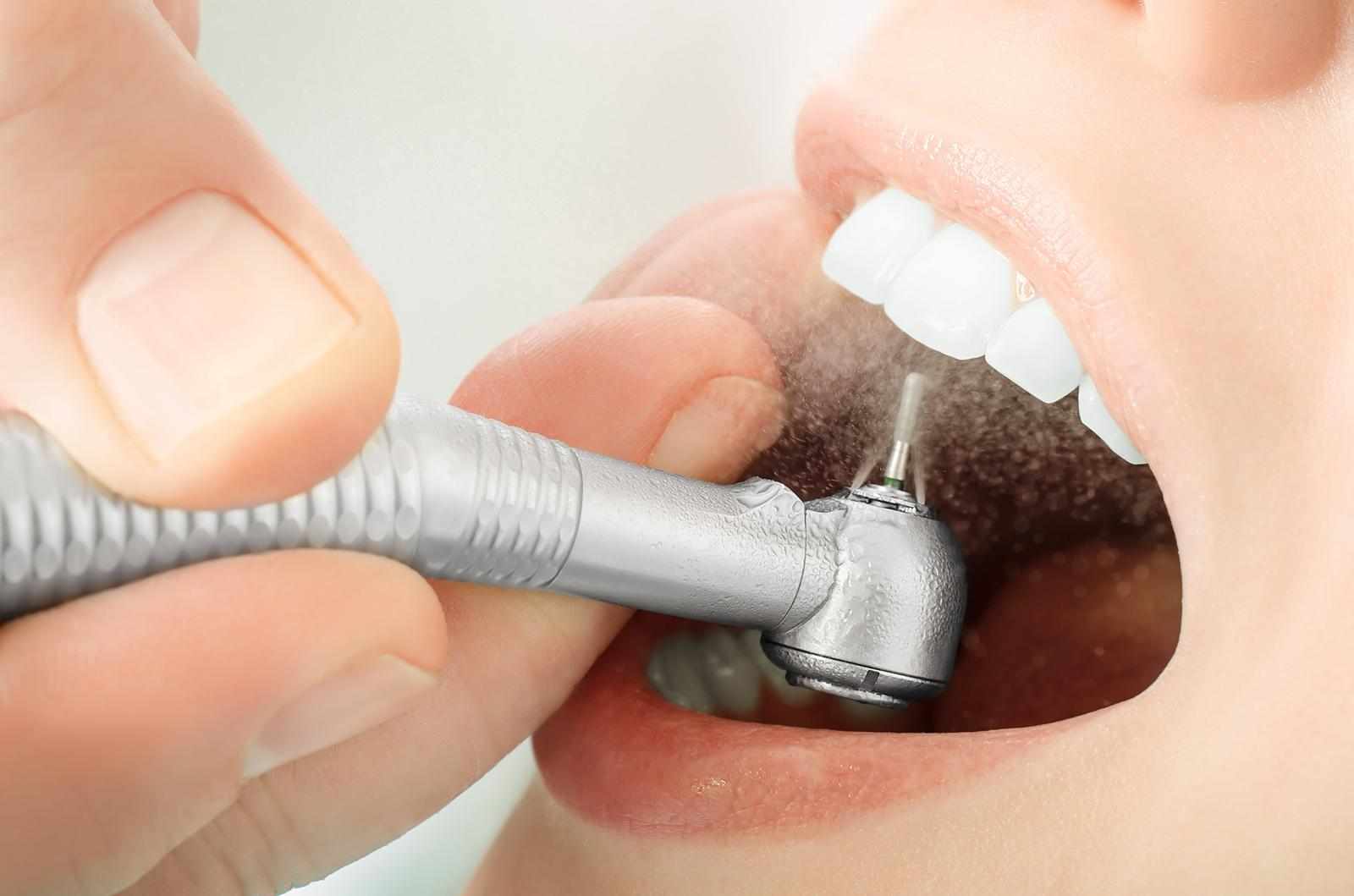 Could Skipping Teeth Cleaning Be Affecting Your Gum Health Without You Knowing?