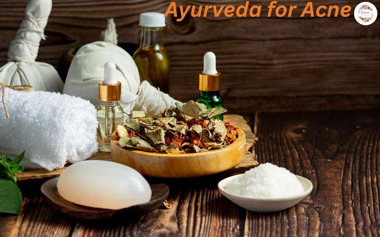 Ayurvedic Treatment for Acne: A Complete Natural Guide by Orancia