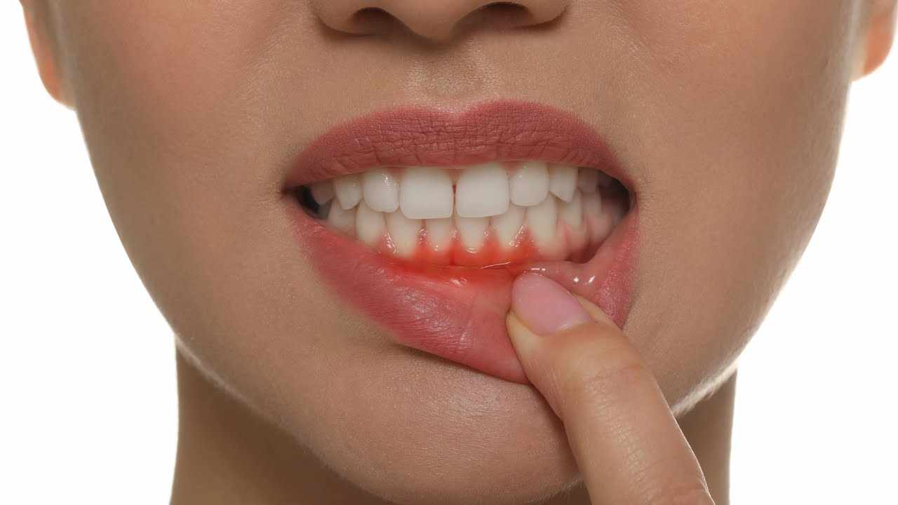 Ignoring Gum Problems? Here’s Why Gum Treatment in Navi Mumbai Is Important