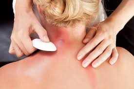 Gua Sha Scraping Therapy for Circulation and Tension Relief