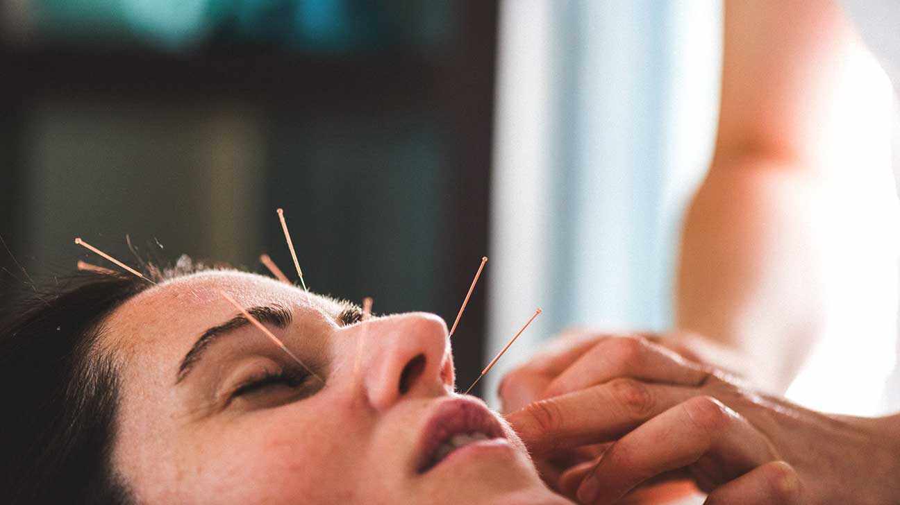 Facial Acupuncture in Richmond for Skin and Muscle Support