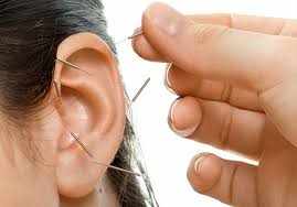 Detox Acupuncture Program in Greater Vancouver