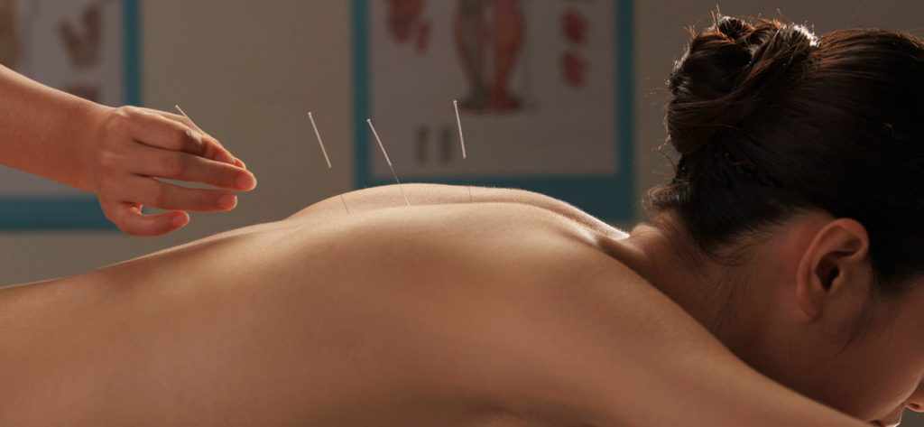 Fatigue Management Through Traditional Chinese Medicine