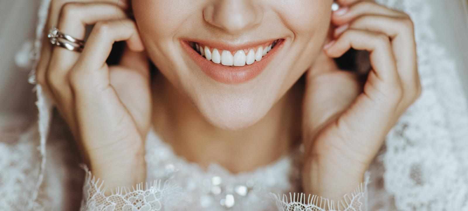 Achieving Your Perfect Bridal Smile Makeover in Mumbai