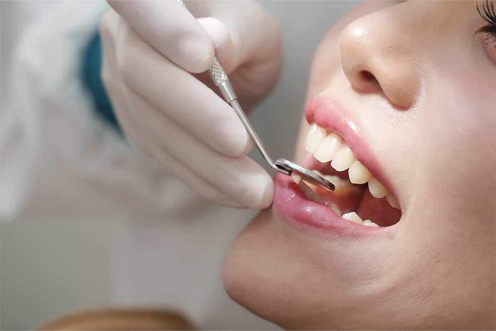 Understanding Teeth Cleaning Cost in Parel Mumbai: A Guide to Oral Maintenance