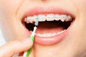What orthodontists in Smyrna offer clear ceramic braces?