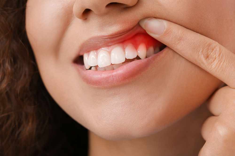 Non-Surgical Gum Treatment Options That Can Save Your Teeth