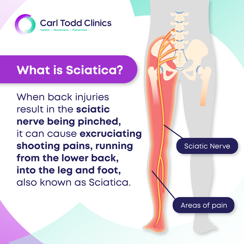 Suffering from Sciatica? Trusted Pain Relief Across the US & Canada