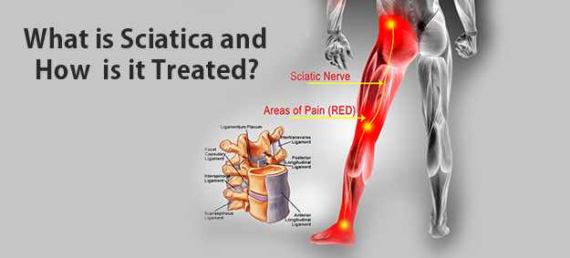 Say Goodbye to Sciatic Pain: Safe Relief Options in the US & Canada