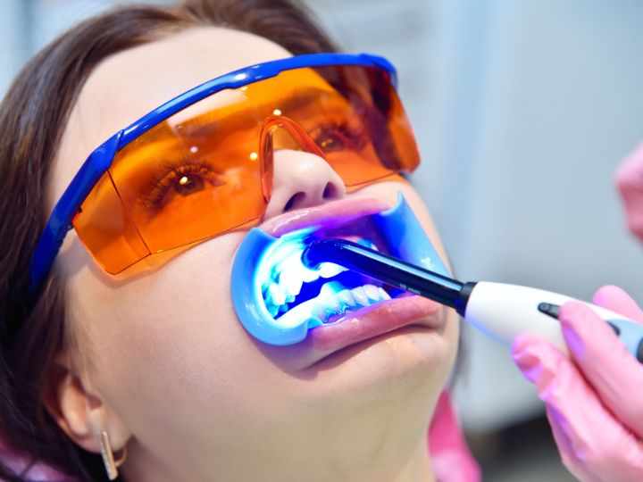 Why Teeth Whitening Is a Smart Investment for Your Smile