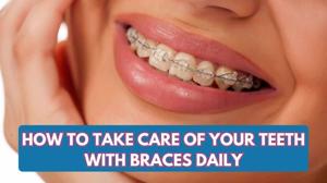 How to Take Care of Your Teeth with Braces Daily