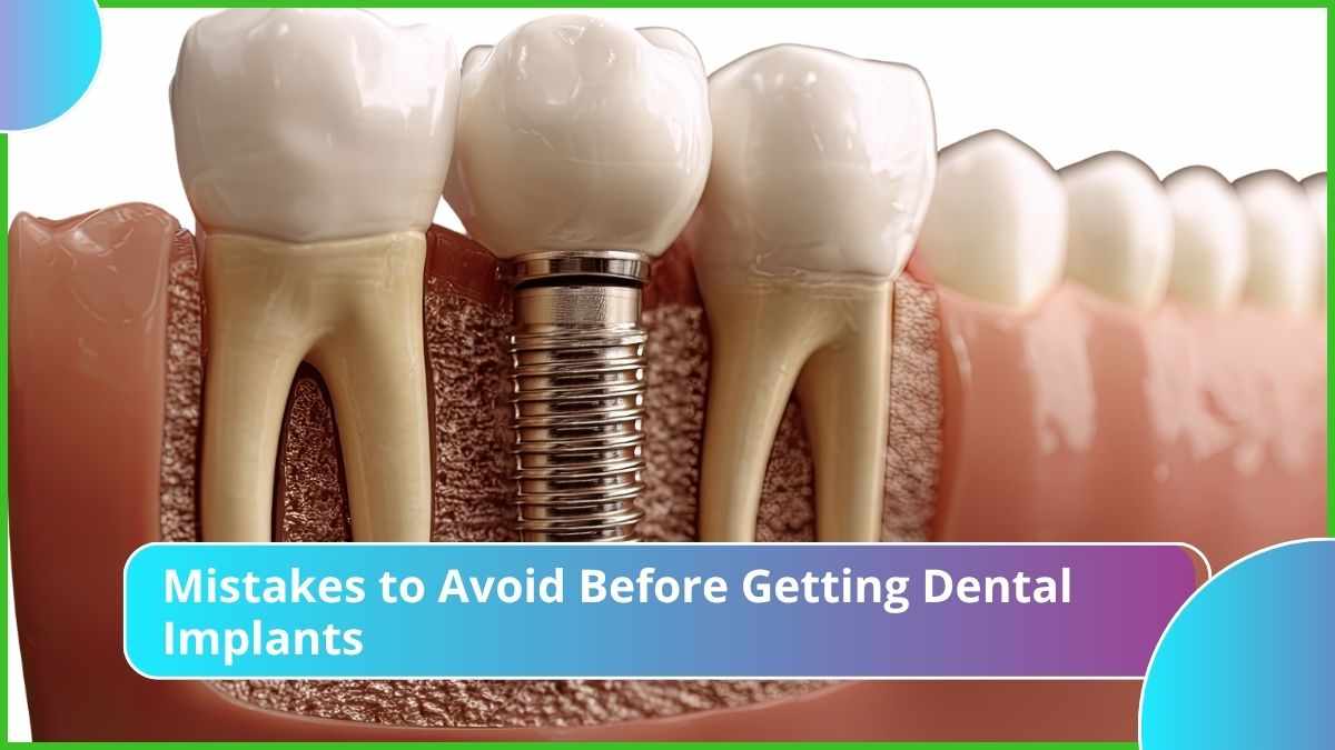 Mistakes to Avoid Before Getting Dental Implants