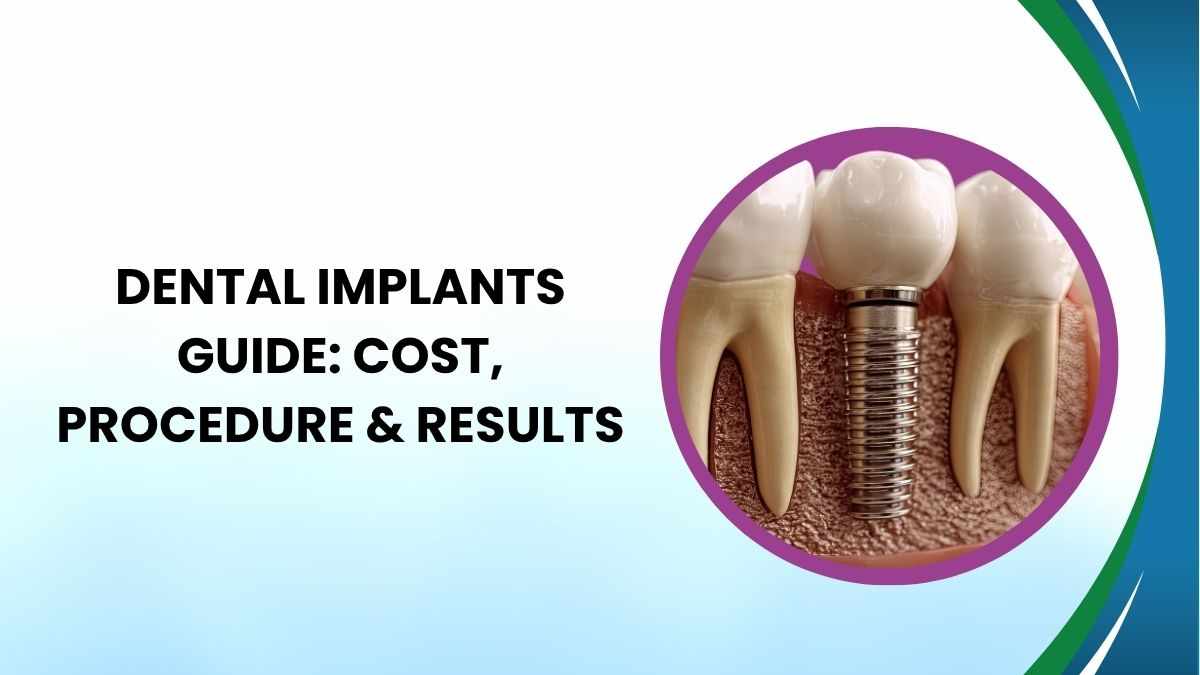 Dental Implants Guide 2026: Cost, Procedure & Results