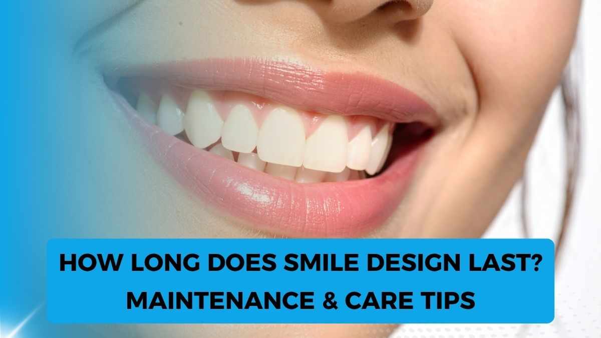 How Long Does Smile Design Last? Maintenance & Care Tips