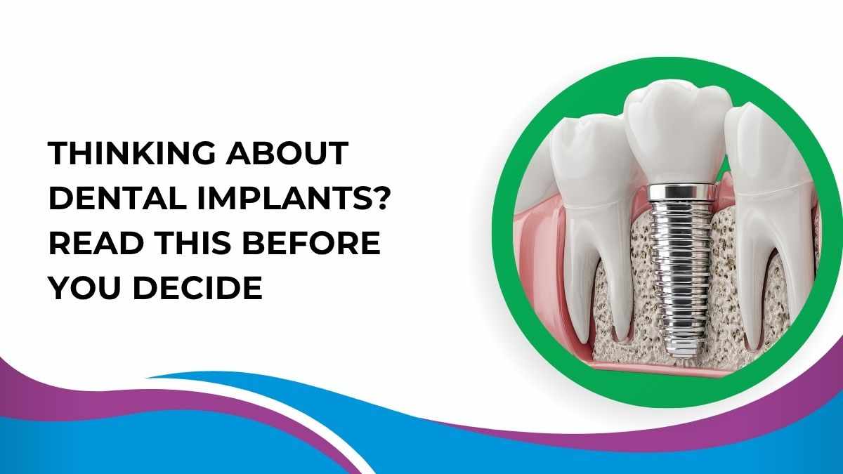 Thinking About Dental Implants? Read This Before You Decide