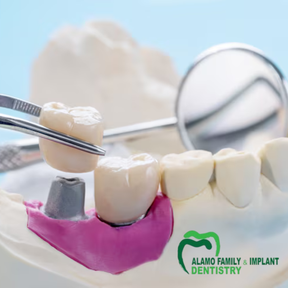 Enjoy a Natural Smile with Dental Crowns in Simi Valley