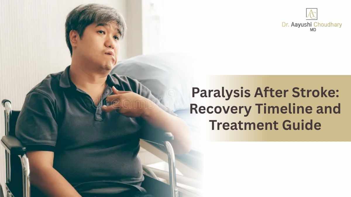 Paralysis After Stroke: Recovery Timeline and Treatment Guide