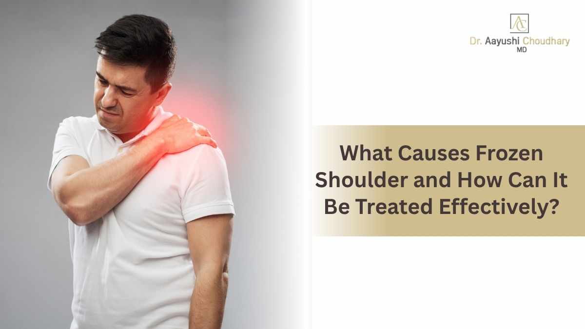 What Causes Frozen Shoulder and How Can It Be Treated Effectively?