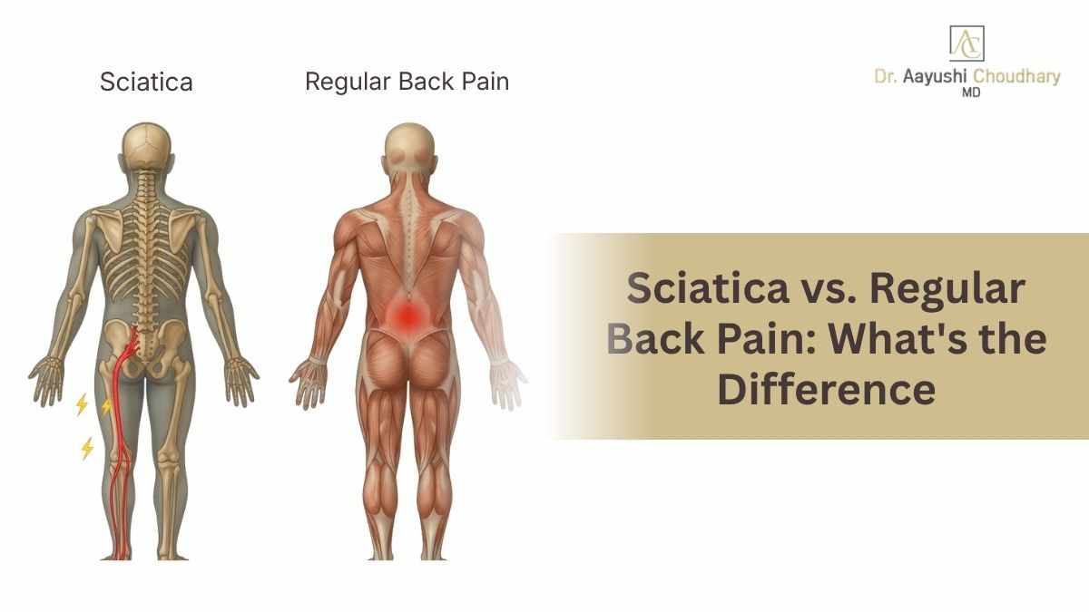 Sciatica vs. Regular Back Pain: What's the Difference? | Expert Guide