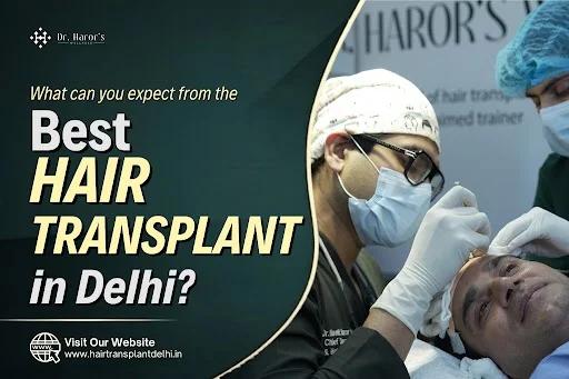 What Can You Expect from the Best Hair Transplant Clinic in Delhi?