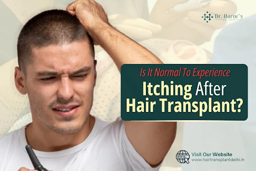 Is It Normal To Experience Itching After Hair Transplant?