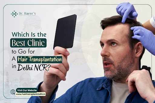 Looking for the Best Hair Transplant Clinic in Delhi NCR? Here's What to Know