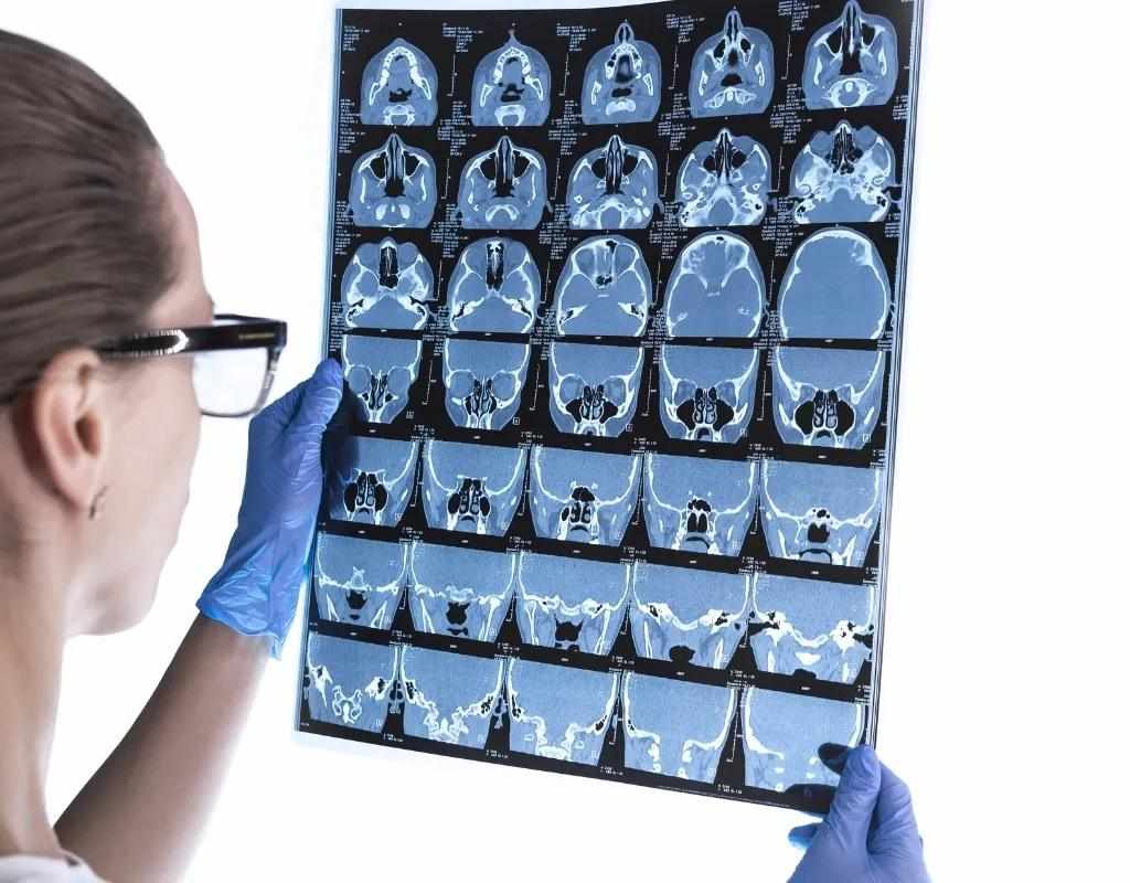 Medical Imaging Media Coating Materials | Consistency & Reliability - Tianjin Boehmax New Materials Co., Ltd.